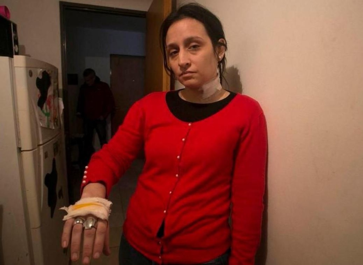 La perito afirmó que Melina Cruz es capaz de "autolesionarse" para que