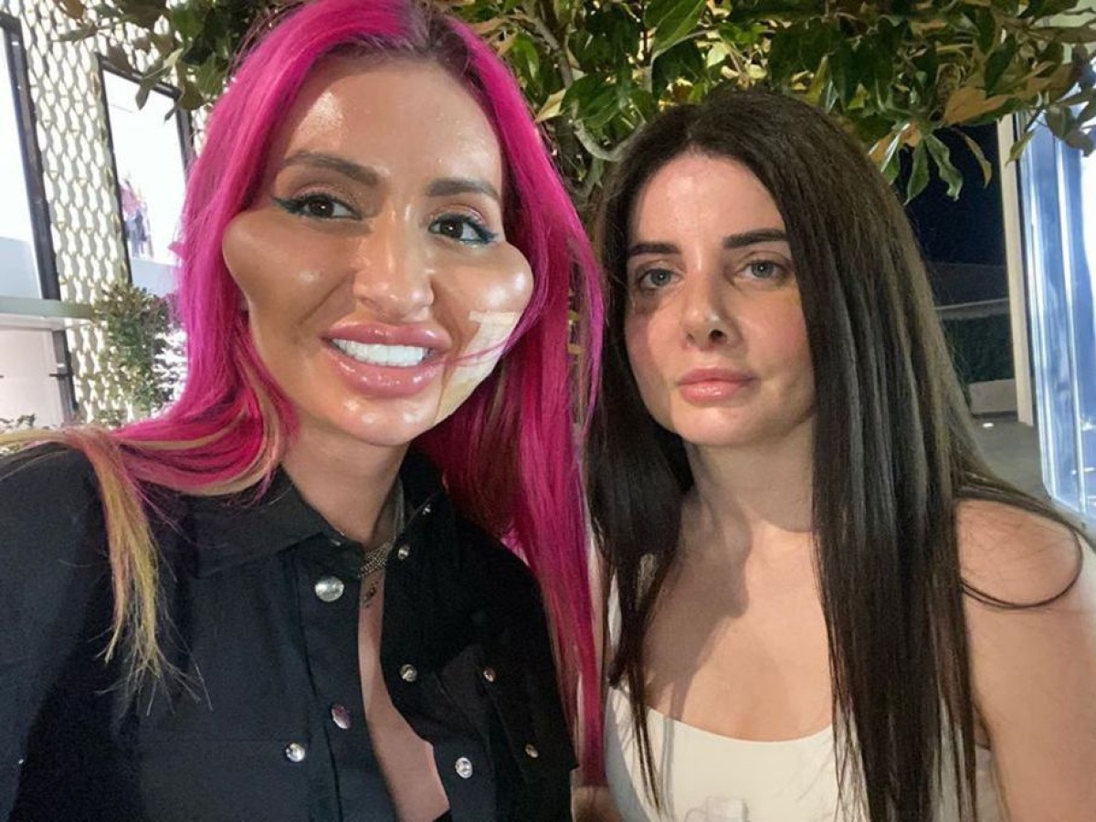 Una instagramer está orgullosa por tener los pómulos más grandes del