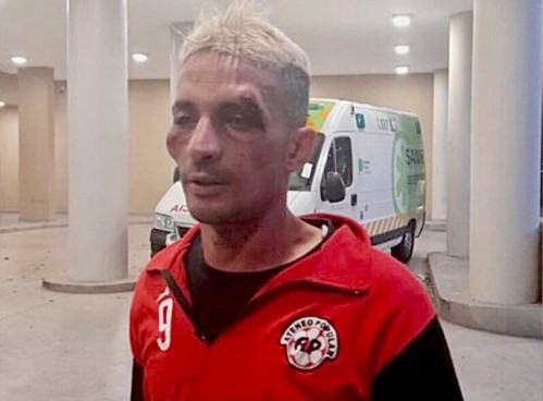 Golpearon salvajemente a un jugador de la Liga Amateur Platense: el club denuncia que fueron emboscados
