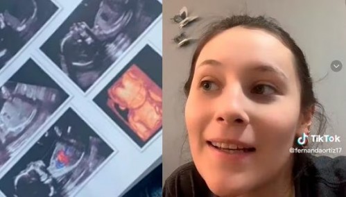 "Sentía sueño excesivo y desmayos": una joven compartió que creyó tener anemia pero estaba embarazada de 5 meses
