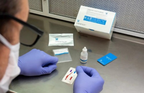 CHEMSTRIP, el nuevo test rápido de anticuerpos para coronavirus que fue creado por científicos argentinos