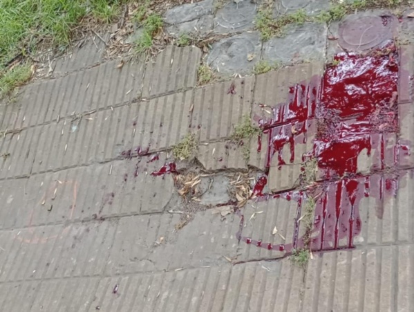 Conmoción en La Plata por un hombre que recibió un disparo a sangre fría por dos delincuentes que le robaron la moto