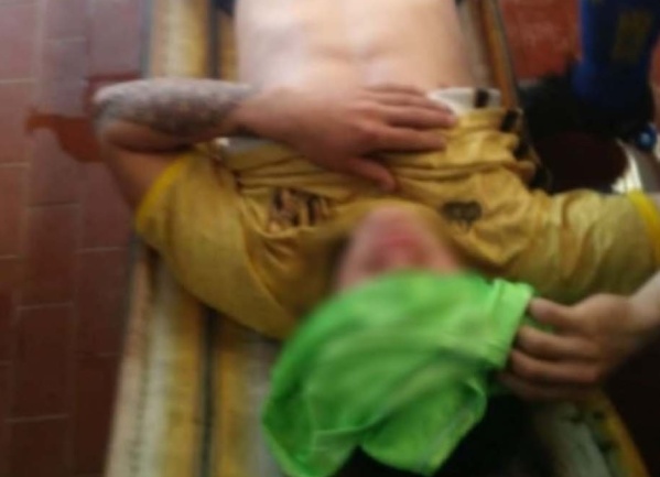 Atacaron con agua hirviendo a un jugador en un partido de la Liga Amateur Platense y fue hospitalizado de urgencia