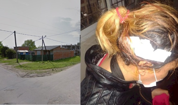 Iba a trabajar, la asaltó un motochorro y terminó con un tajo en la cabeza en La Plata