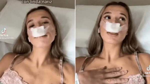 Una joven publicó que se iba hacer una cirugía estética pero sorprendió cuando mencionó el motivo