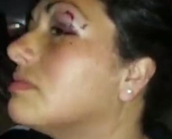 "Tiene la cara desfigurada y estaba en shock": una vecina de Berisso denunció que fue golpeada en la comisaría cuarta