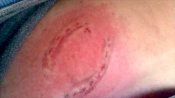 Delincuente atac&oacute; a mordiscos a un comerciante platense para robarle