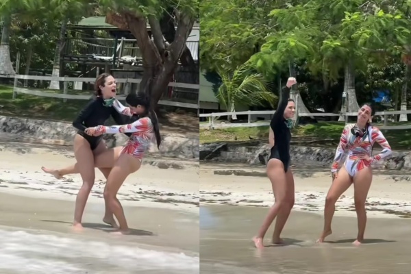 "Marcando territorio": estaba en el mar, sufrió una picadura y el video donde su amiga le orina la pierna se hizo viral