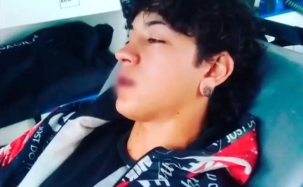 Una patota le desfigur&oacute; la cara y le fractur&oacute; el maxilar a un adolescente: &ldquo;Salvador fue casi otro Fernando B&aacute;ez Sosa&rdquo;