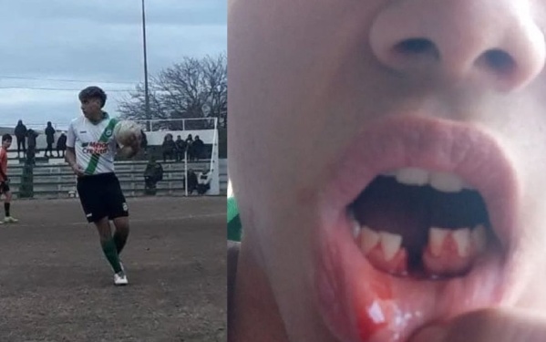 La violencia ataca en la Liga Amateur Platense: un joven debi&oacute; ser hospitalizado