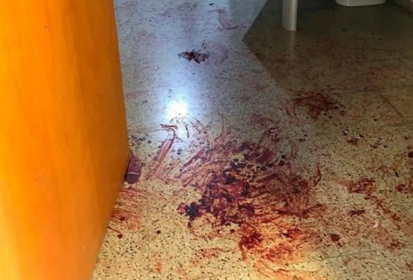 Horror: encontraron un charco de sangre y las paredes manchadas en un baño de la Facultad de Arquitectura de Córdoba