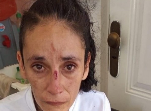 Piedrazos en la Autopista Buenos Aires - La Plata: una militante fue herida cuando se dirigían al acto de Cristina