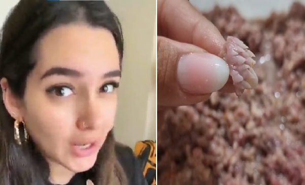 Compró carne picada donde encontró restos extraños, criticó al carnicero y generó polémica en las redes