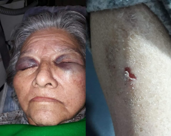 Denunciaron penalmente al geriátrico platense Santa Teresita de Ávila: una abuela fue hallada en el piso y con graves heridas