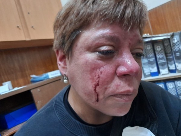 Los dueños de un local gastronómico golpearon brutalmente a una inspectora municipal en La Plata