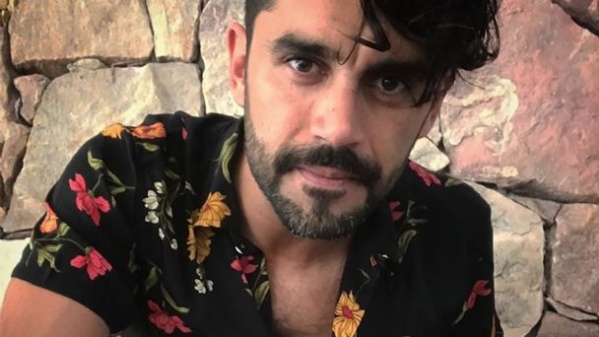 Gonzalo Heredia llamó la atención de sus fans con una foto ¿Qué le pasó?