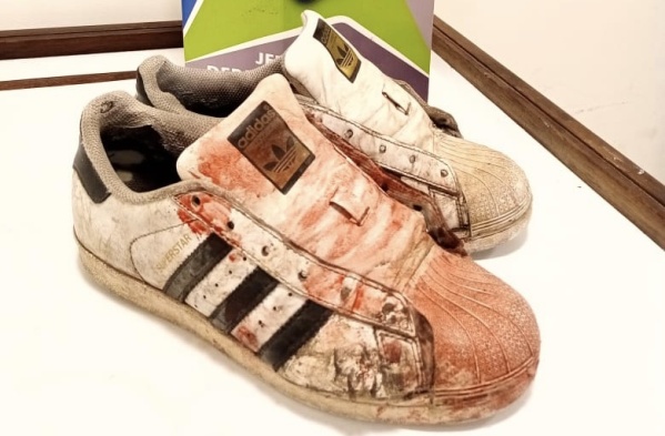 Pelea vecinal termin&oacute; con un hombre internado por un piedrazo en la cabeza