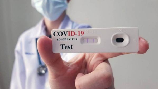 Aseguran que los primeros autotest de COVID-19 estarían disponibles la próxima semana en farmacias, a 1.560 pesos