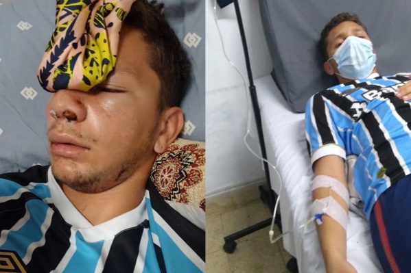 Violencia en la Liga Amateur Platense: &iquest;C&oacute;mo se encuentra el joven que fue brutalmente golpeado en un partido?