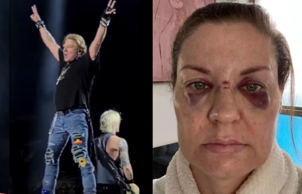 El líder de Guns N` Roses golpeó a una fanática luego de arrojar su micrófono al público: comunicó que dejará de hacerlo