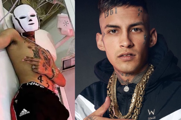 El curioso tratamiento facial al que se somete L-Gante para cuidar su piel