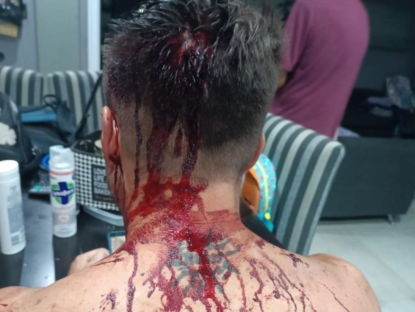 Un vecino de La Plata se defendió de 5 delincuentes armados: les sacó el arma e impidió el robo