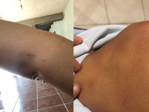 Una joven denuncia que fue maltratada por policías en La Plata: "Me arrastraron y dejaron en corpiño"