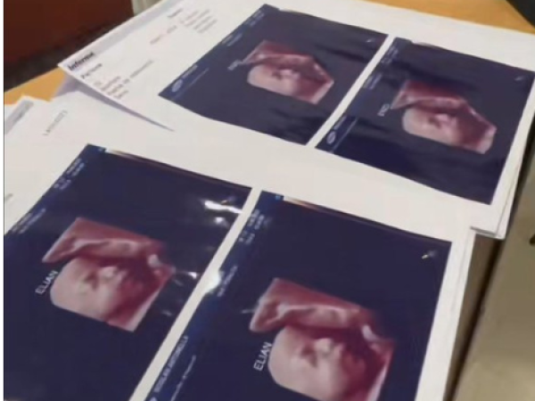 Fueron a hacerse una ecografía 5D, descubrieron por las redes que les daban la misma foto a todas las embarazadas y son viral