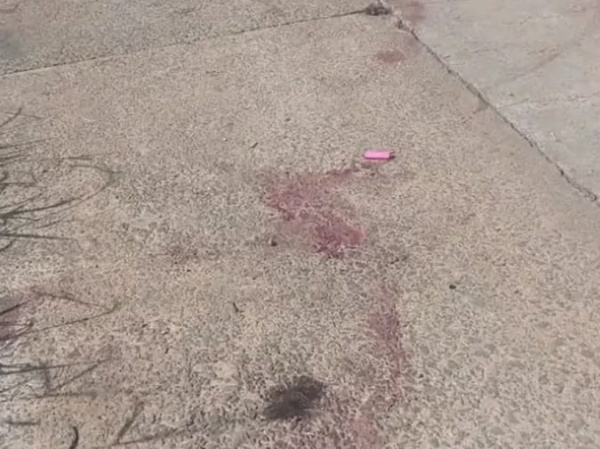 Conmoción por una mujer en situación de calle que fue asesinada por tres perros pitbull