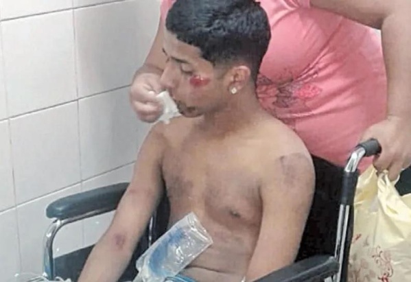 Patovicas desfiguraron a un joven, le gatillaron por la espalda y lo desecharon a pocas cuadras