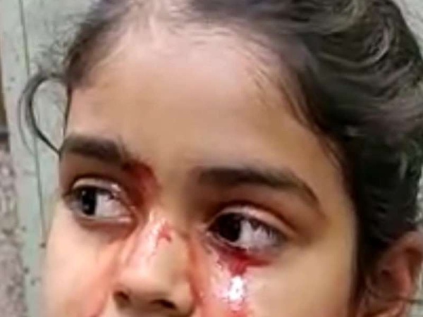 Misterio por nena india que llora sangre