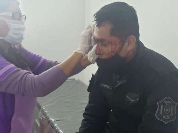 Un policía sufrió hundimiento de cráneo por querer frenar un partido de fútbol ilegal en Salta
