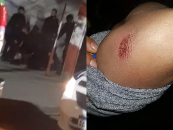 Policías salvajes de Los Hornos le pegaron a una señora por tener una cerveza y todo quedó grabado