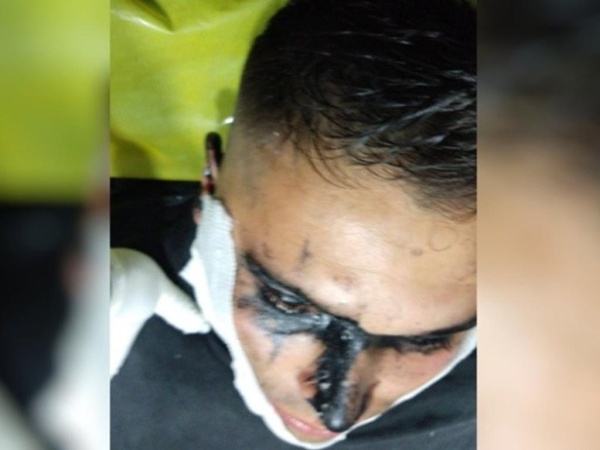 Santa Fe: su madre lo denunció por violento y antes de ser detenido, le arrojó pintura asfáltica en la cara a un policía