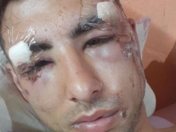 Lo chocaron en La Plata, el auto se dio a la fuga y lo buscan desesperadamente pidiendo justicia: "No me acuerdo nada del impacto"