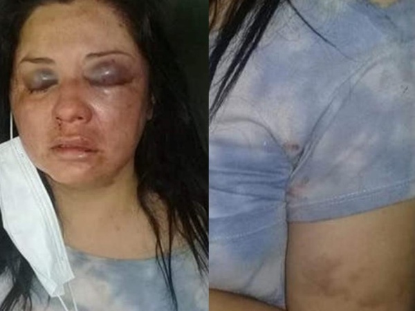 Una mujer se escapó del hospital en Tucumán por miedo a que su marido la mate 