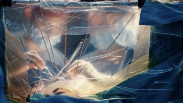 La operaron del cerebro mientras estaba despierta y el resultado sorprendi&oacute; a los m&eacute;dicos bonaerenses