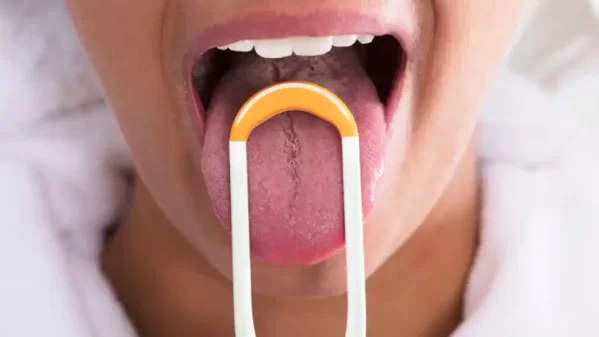 El color de la lengua puede advertir el estado de tu salud