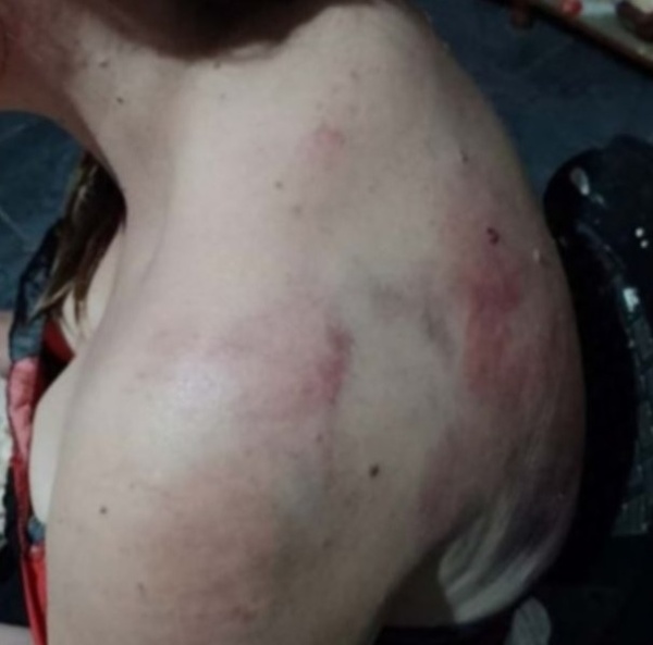 Estaba en la Isla Paulino, fue atropellada por un caballo y la socorrieron en lancha