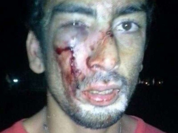 Un músico fue agredido por la seguridad de la República de los Niños en el Carnaval