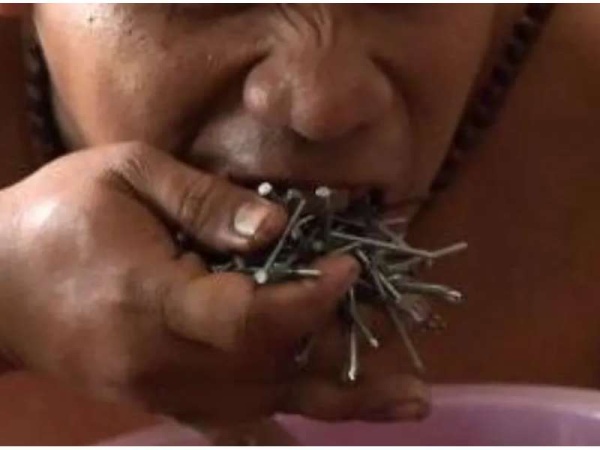 Fue al m&eacute;dico por un dolor de est&oacute;mago: se hab&iacute;a tragado 116 clavos