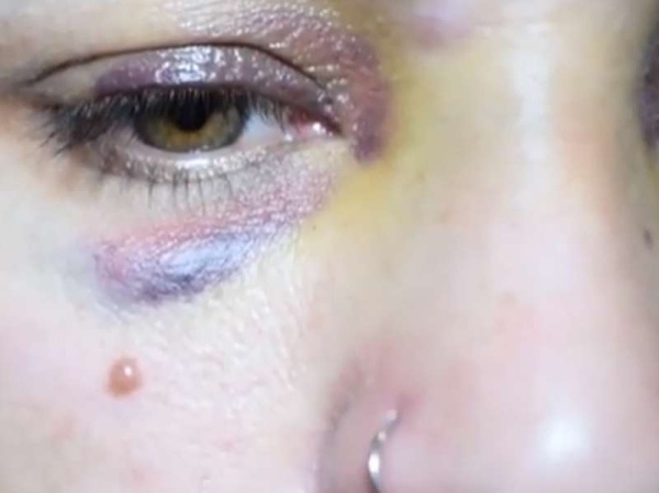 Joven platense denunció que su ex pareja la golpea para matarla