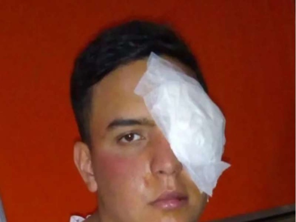 Un menor fue brutalmente golpeado por un patovica en un boliche de Moreno
