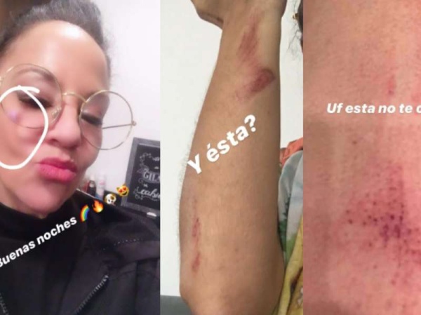 Miss Bolivia denunció a su ex por violencia de género