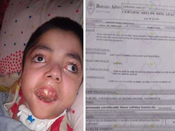 Uriel vive en La Plata, es discapacitado y necesita acondicionar su pieza porque sufre frío