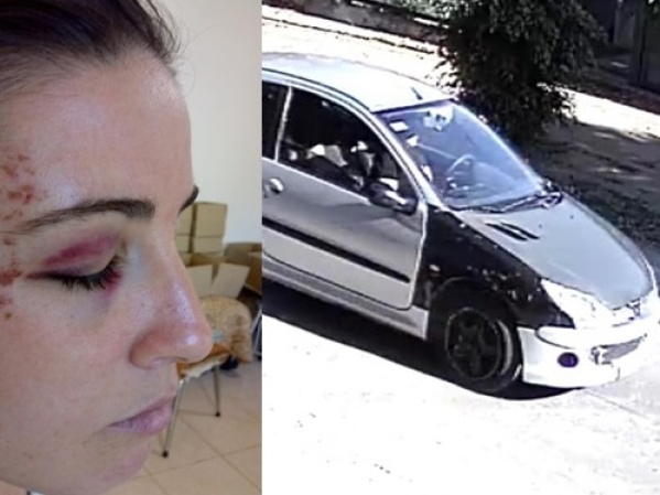 Una mujer busca en La Plata a una conductora que la chocó: "La tomografía sale 10 mil pesos y necesito ubicarla"