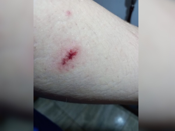 Circulaba con su bicicleta y fue atacado a balazos de aire comprimido en Tolosa