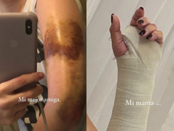 Wanda Nara mostró las impresionantes heridas que sufrió su familia: "Puedo con todo y todos"