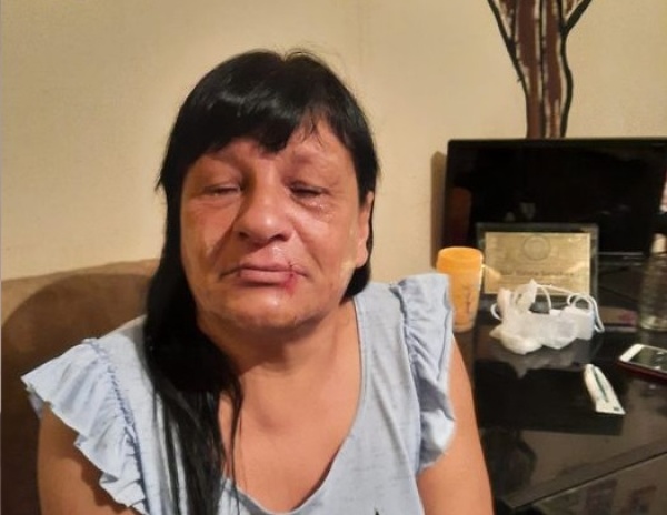 El fiscal recibió a Estela Sánchez, la vecina de Villa Elvira que se cosió la boca: le pidió que deponga su huelga