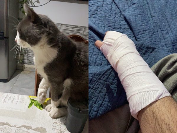 Él se quebró la mano, su gato renguea y se hizo viral: "El veterinario me dijo que me imita"